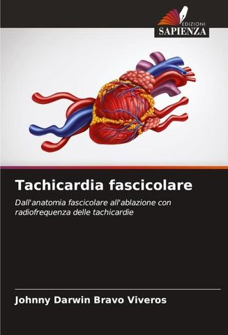 Tachicardia fascicolare