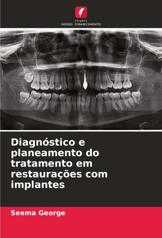 Diagnóstico e planeamento do tratamento em restaurações com implantes