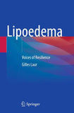 Lipoedema