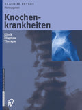 Knochenkrankheiten