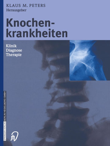 Knochenkrankheiten