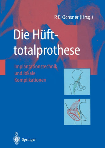 Die Hüfttotalprothese