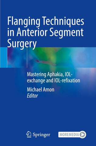 Flanging Techniques in Anterior Segment Surgery