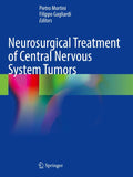 Neurosurgical Treatment of Central Nervous System Tumors