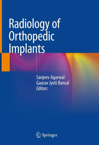 Radiology of Orthopedic Implants