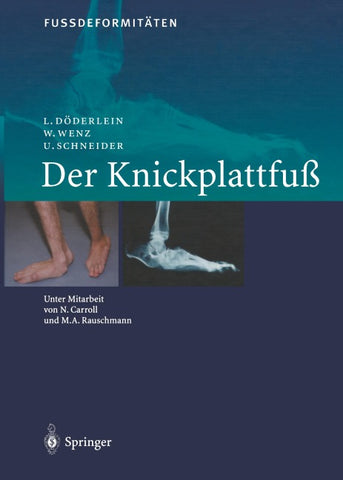 FussdeformitÄten