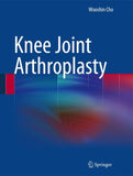Knee Joint Arthroplasty