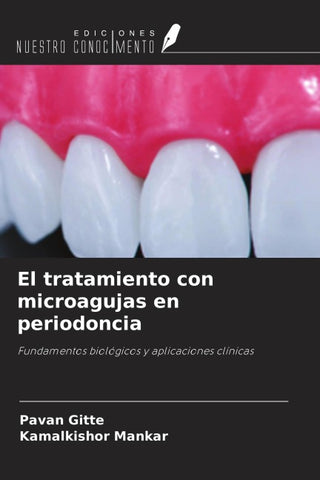 El tratamiento con microagujas en periodoncia