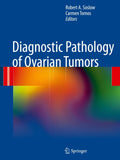 Diagnostic Pathology of Ovarian Tumors