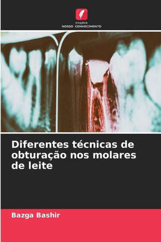 Diferentes técnicas de obturação nos molares de leite