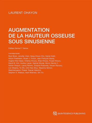 Augmentation de la hauteur osseuse sous sinusienne