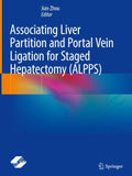 Associating Liver Partition and Portal Vein Ligation for Staged Hepatectomy (ALPPS)