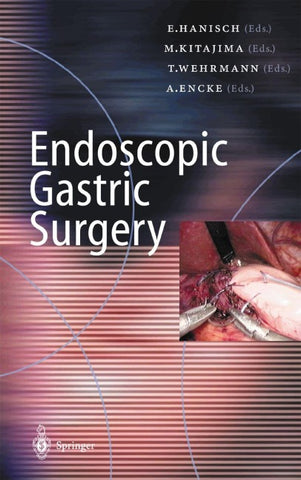 Endoscopic Gastric Surgery