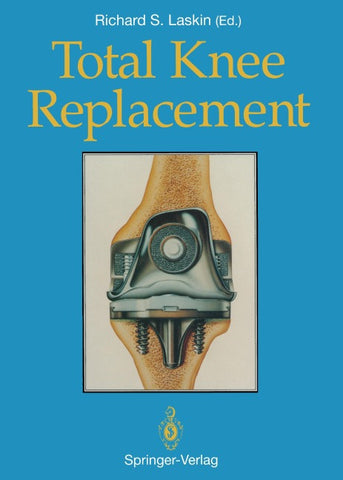 Total Knee Replacement