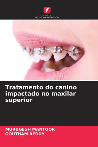 Tratamento do canino impactado no maxilar superior