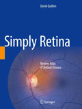 Simply Retina
