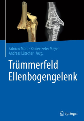 Trümmerfeld Ellenbogengelenk