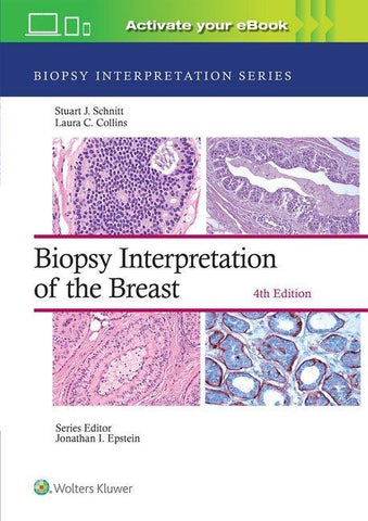Biopsy Interpretation of the Breast: Print + eBook with Multimedia