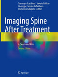 Imaging Spine After Treatment