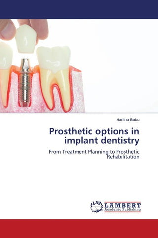 Prosthetic options in implant dentistry