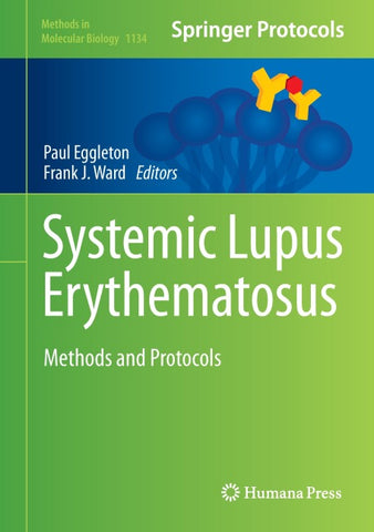 Systemic Lupus Erythematosus