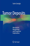 Tumor Deposits