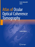Atlas of Ocular Optical Coherence Tomography