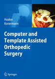 Computer and Template Assisted Orthopedic Surgery