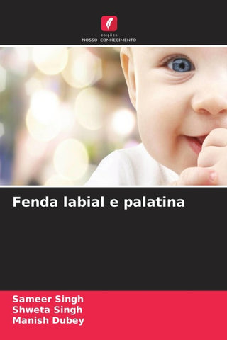Fenda labial e palatina