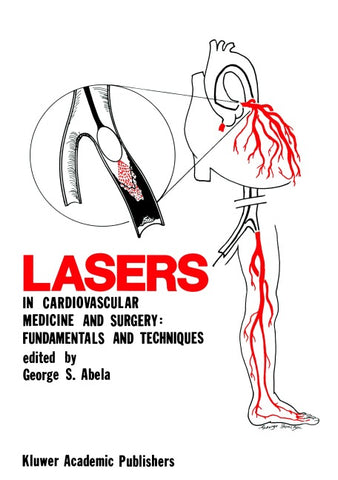 Lasers in Cardiovascular Medicine and Surgery: Fundamentals and Techniques