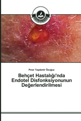 Behçet Hastal¿¿¿'nda Endotel Disfonksiyonunun De¿erlendirilmesi