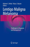 Lentigo Maligna Melanoma