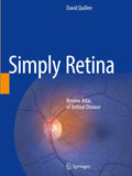 Simply Retina
