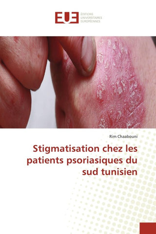 Stigmatisation chez les patients psoriasiques du sud tunisien