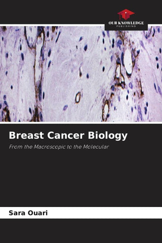 Breast Cancer Biology