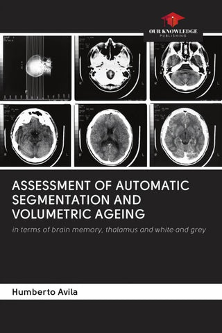 ASSESSMENT OF AUTOMATIC SEGMENTATION AND VOLUMETRIC AGEING