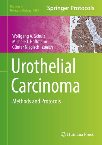 Urothelial Carcinoma