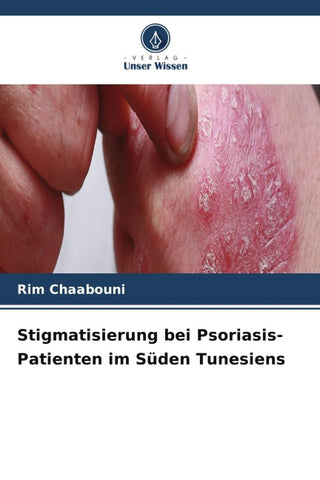 Stigmatisierung bei Psoriasis-Patienten im Süden Tunesiens