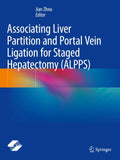 Associating Liver Partition and Portal Vein Ligation for Staged Hepatectomy (ALPPS)
