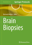 Brain Biopsies
