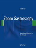 Zoom Gastroscopy