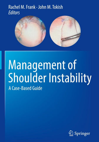 Management of Shoulder Instability