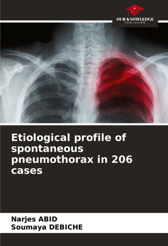 Etiological profile of spontaneous pneumothorax in 206 cases