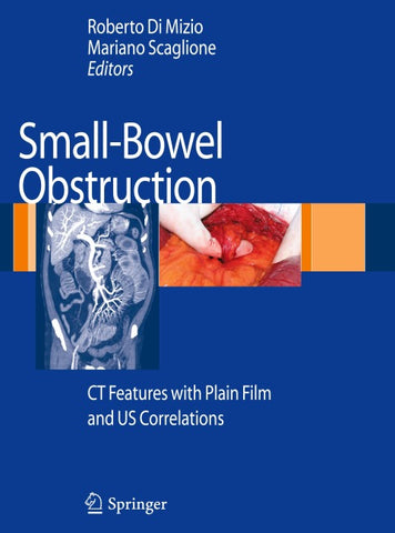 Small-Bowel Obstruction