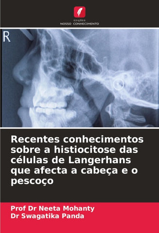 Recentes conhecimentos sobre a histiocitose das células de Langerhans que afecta a cabeça e o pescoço
