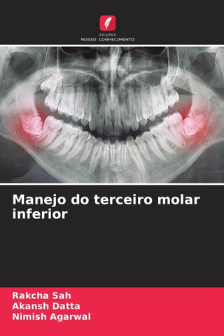 Manejo do terceiro molar inferior