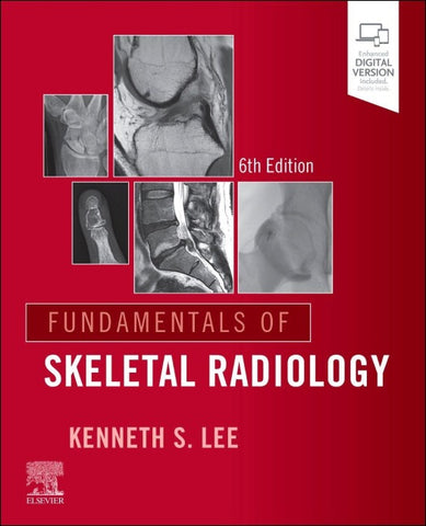 Fundamentals of Skeletal Radiology