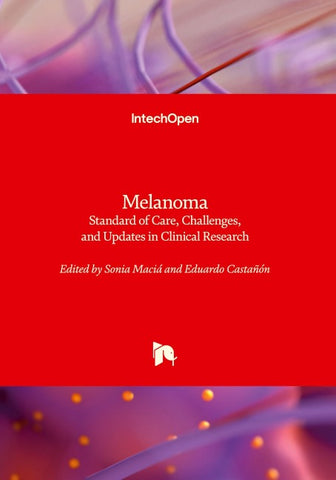 Melanoma