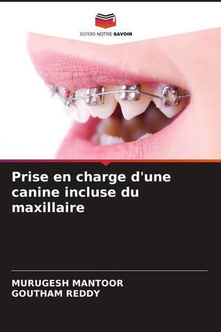 Prise en charge d'une canine incluse du maxillaire