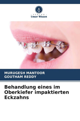 Behandlung eines im Oberkiefer impaktierten Eckzahns